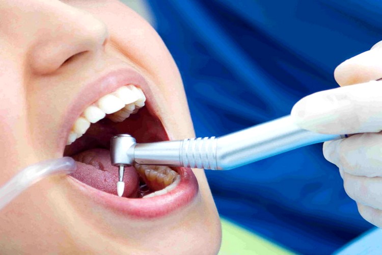 oradent-servicii-odontoterapia oradent-servicii-odontoterapia