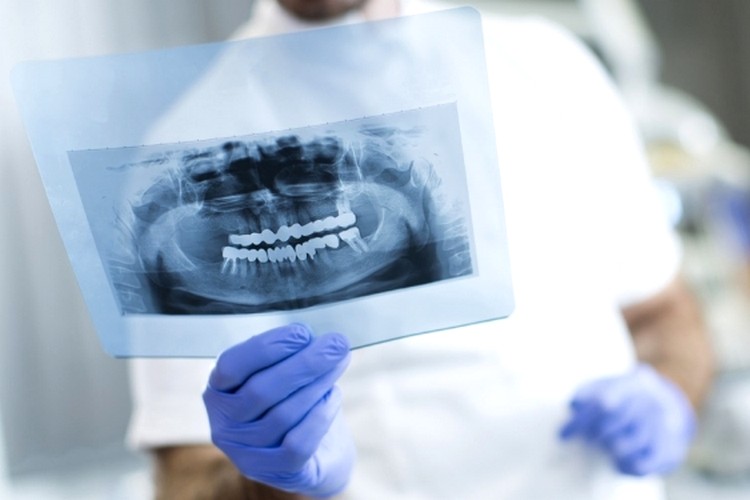 oradent-servicii-radiologie oradent-servicii-radiologie